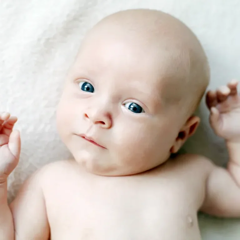 torticollis-cover